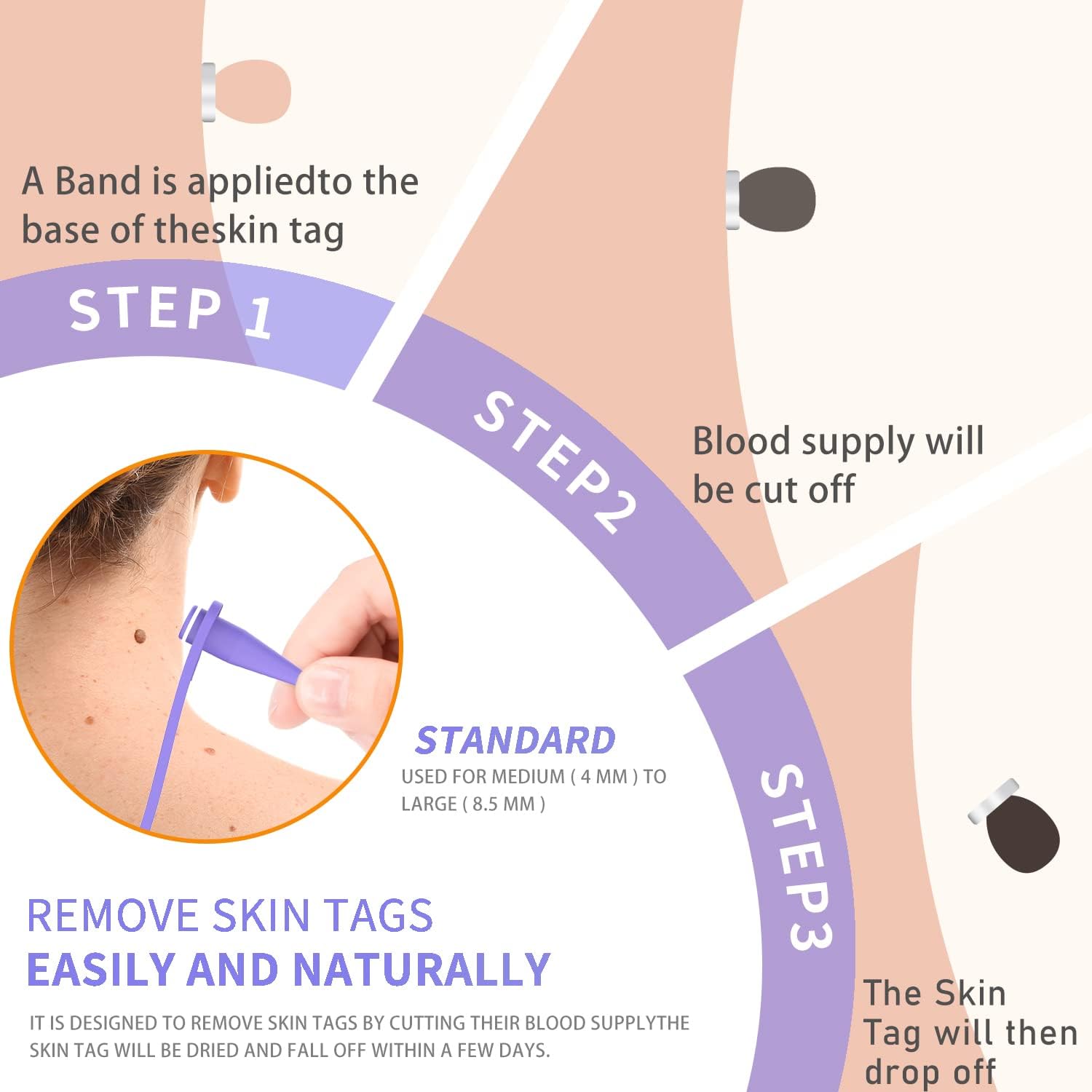 2 in 1 skin tag removal kit safe for small to large (2mm 8.5mm) skin tags for most body 2 in 1 skin tag removal kit safe for small to large (2mm 8.5mm) skin tags for most body