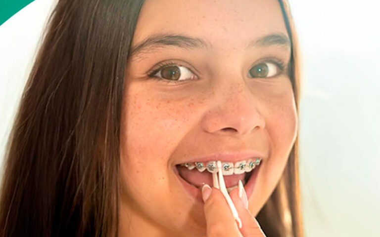 platypus orthodontic flossers