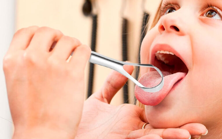 stainless steel metal tongue scraper